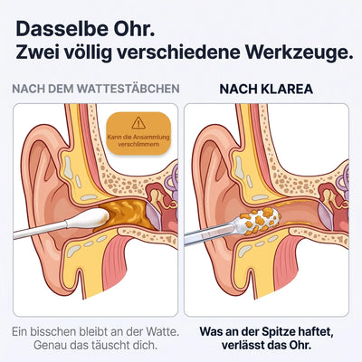 Klarea Pro® Haftender Ohrenreiniger