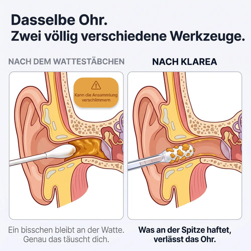 Klarea Pro® Haftender Ohrenreiniger